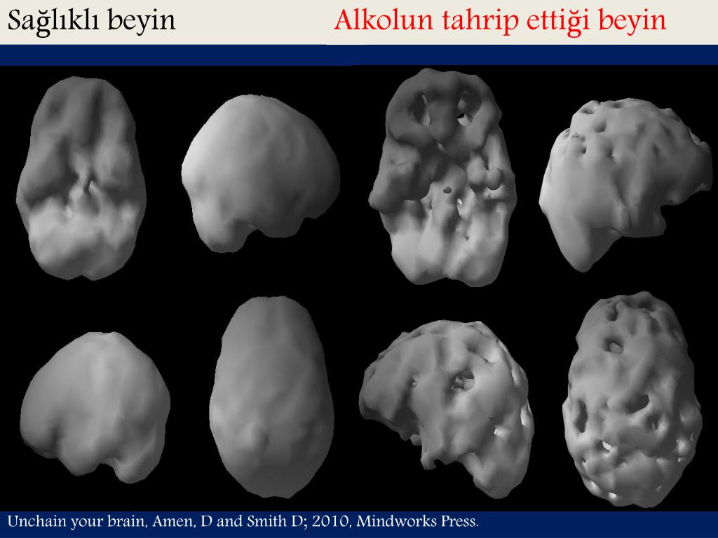 slide17-l.jpg